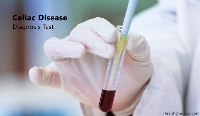 celiac disease diagnosis test