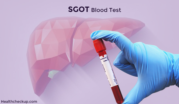 sgot blood test