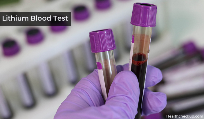 Lithium Blood Test Preparation, Procedure, Resutls, Side Effects