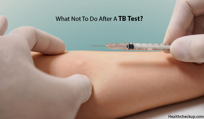 What not to do after a tb test?