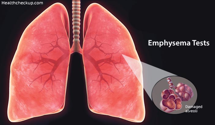 Emphysema Tests - Prep, Procedure, Results, Treatment by Dr Kaushal