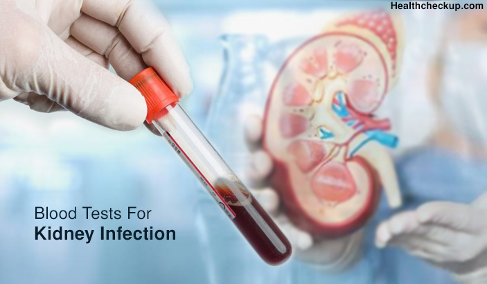 Blood Tests For Kidney Infection - Prep, Procedure, Results Interpretaiton