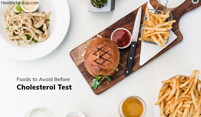 List of Foods To Avoid Before A Cholesterol Test