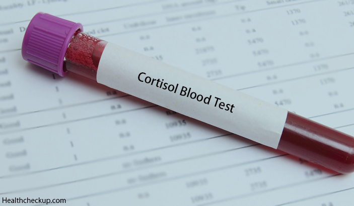 Cortisol Blood Test