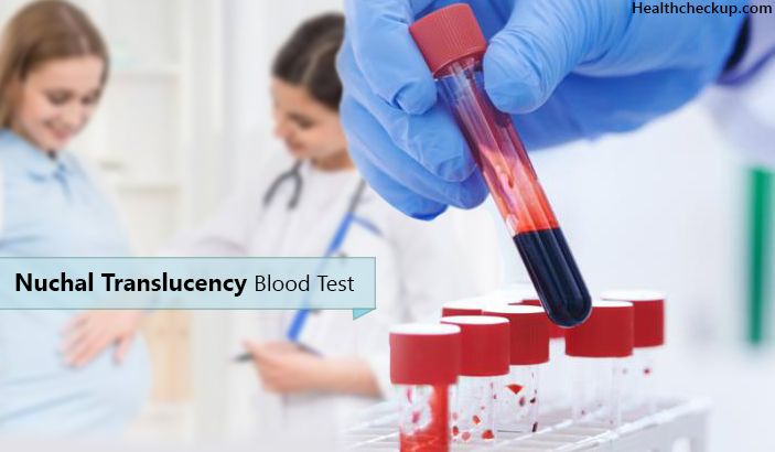 Nuchal Translucency Blood Test