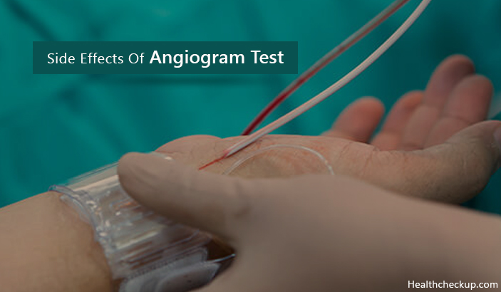 Risks and Side Effects of Angiogram Test