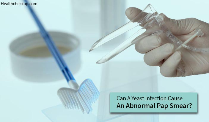 Can A Yeast Infection Cause An Abnormal Pap Smear?