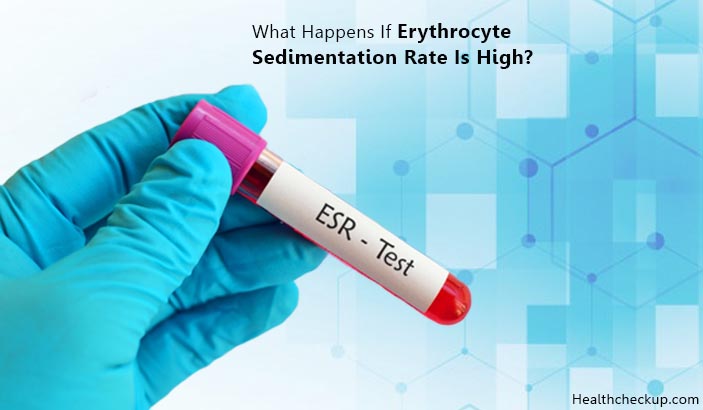 What Happens If Erythrocyte Sedimentation Rate is High