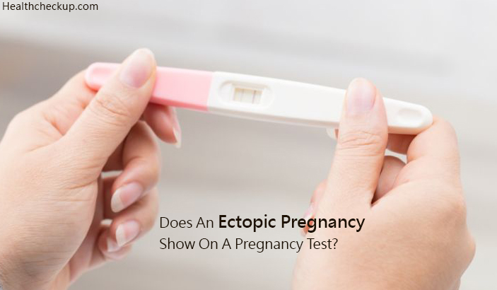 Does an ectopic pregnancy show on a pregnancy test?