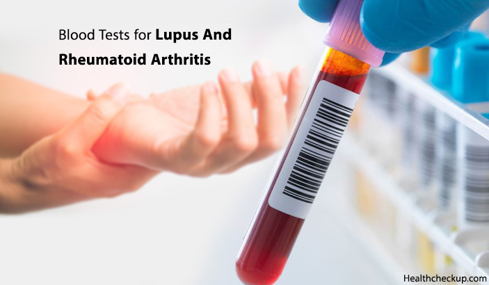 Blood Tests for Lupus And Rheumatoid Arthritis