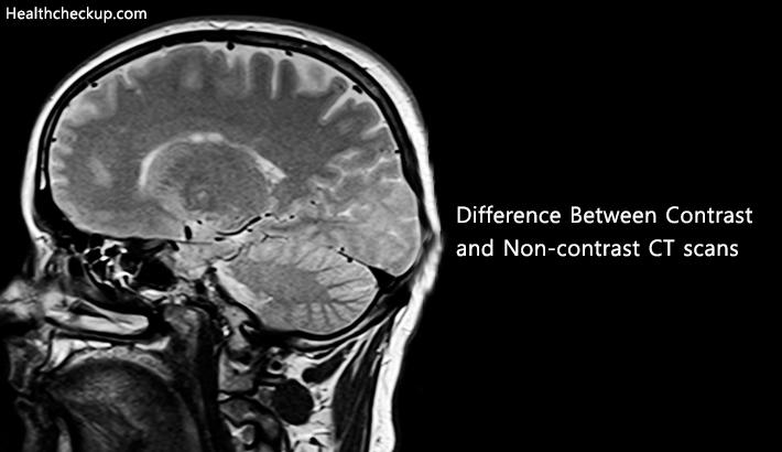 difference between contrast and noncontrast ct scan