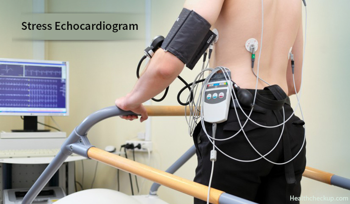 Stress Echocardiogram - Indications, Prep, Procedure and Results