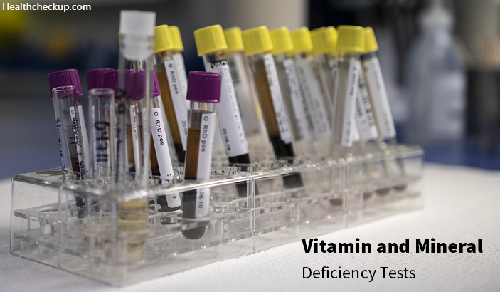 Blood Test for Minerals and Vitamin Deficiencies