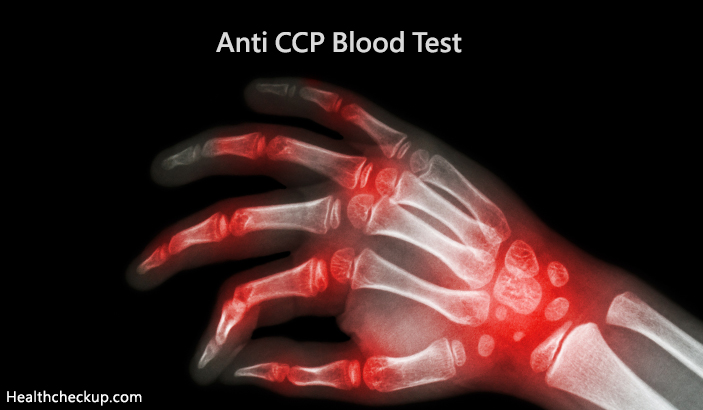 Anti CCP Blood Test