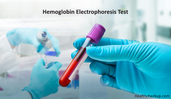 What is Hemoglobin Electrophoresis Test? Normal Levels, Purpose, Results