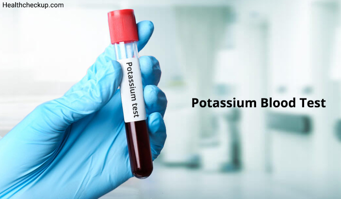 Potassium Blood Test: Low, High and Normal Range