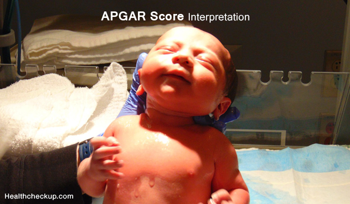 APGAR Score Interpretation - Low, High and Normal