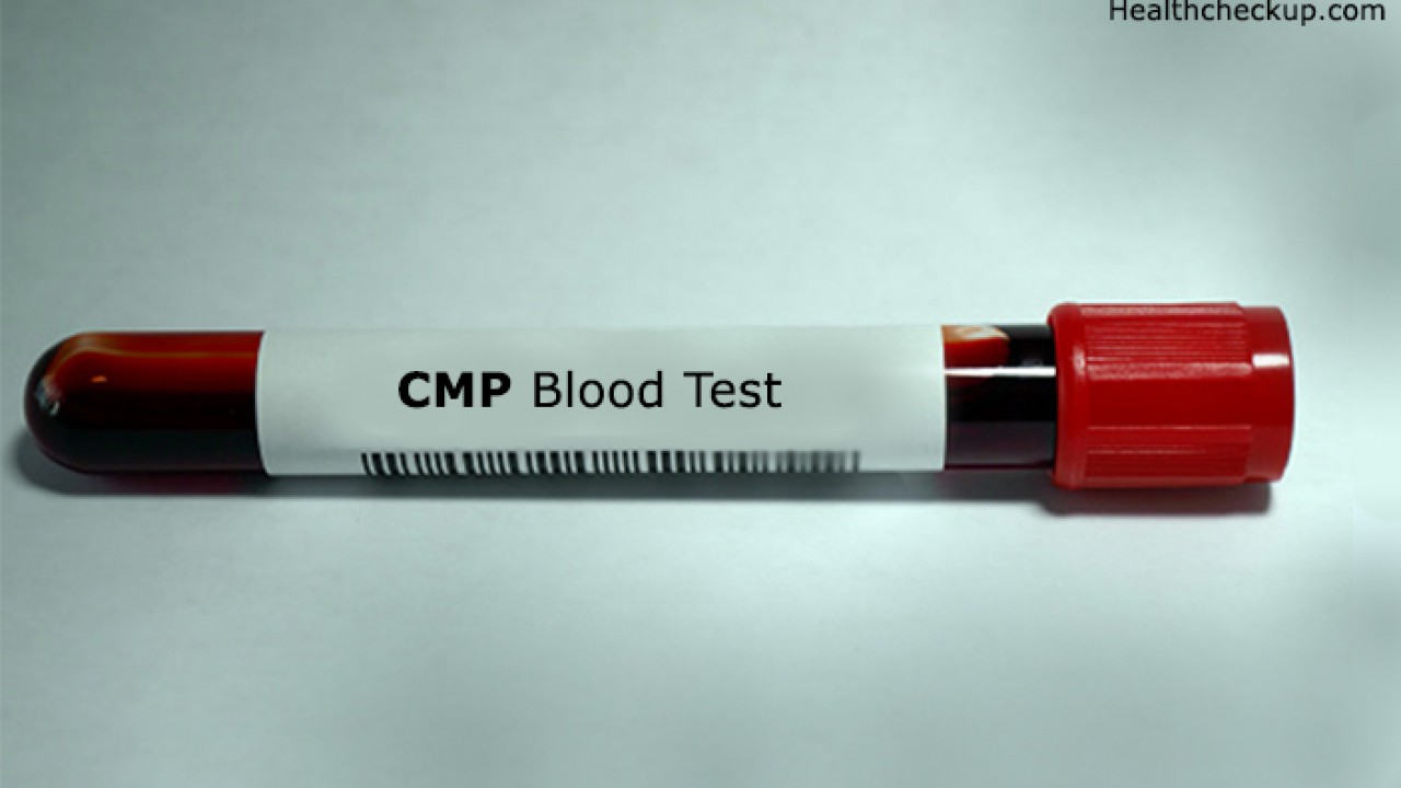 معنی اصطلاحات آزمایش خون