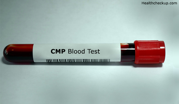 CMP Blood Test