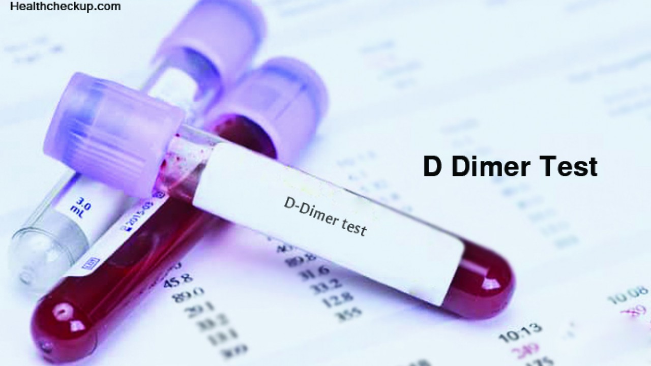 D Dimer Blood Test - Accuracy, Purpose, Procedure, And Normal Range