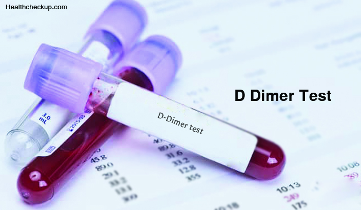 What is a D Dimer Blood Test?