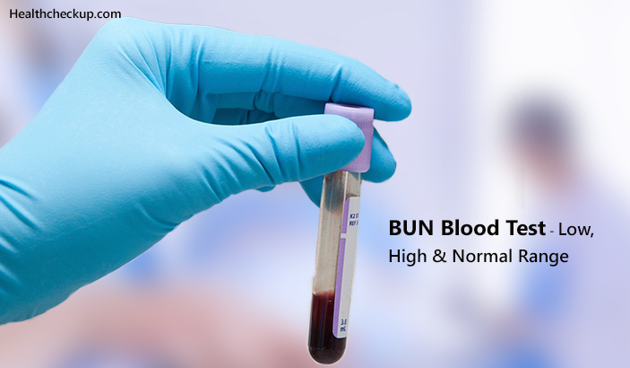 BUN Blood Test - Low, High & Normal Range