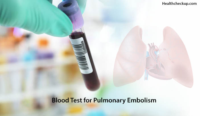 Blood-Test-for-Pulmonary-Embolism