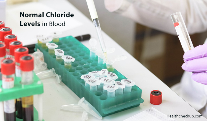 Normal Chloride Levels in Blood