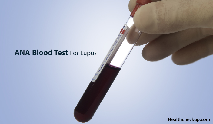 ANA Blood Test For Lupus