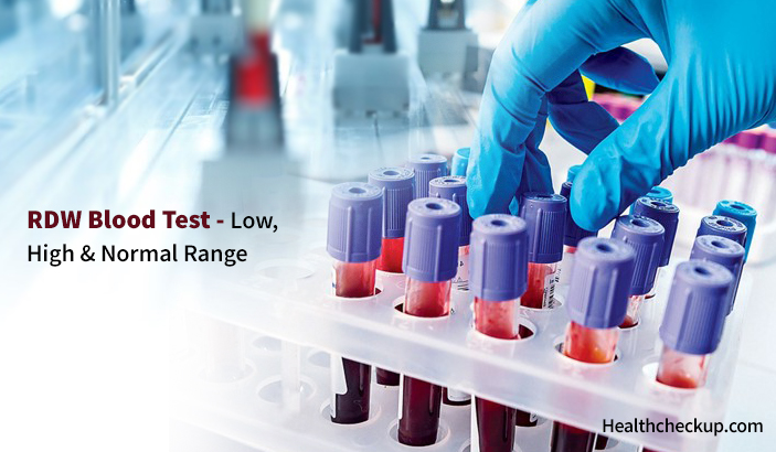 RDW Blood Test- High, Low & Normal Range