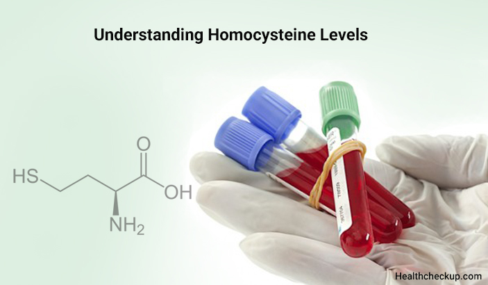 High Homocysteine Levels