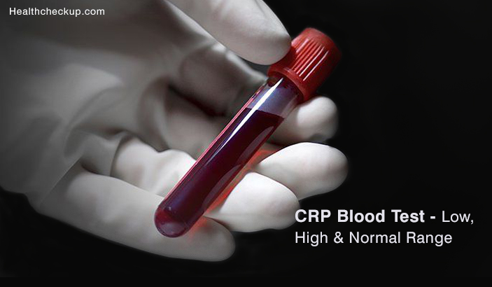 CRP Blood Test - High, Low & Normal Range