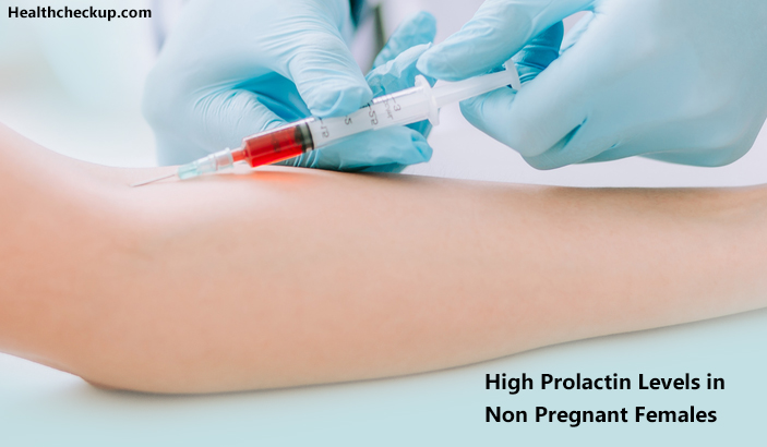 High Prolactin Levels in Non Pregnant Females