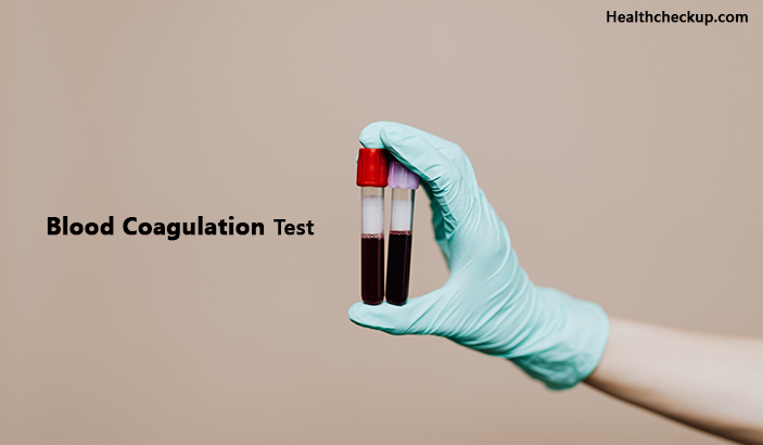 Blood coagulation test