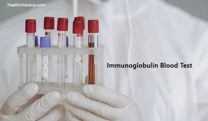 Immunoglobulin blood test
