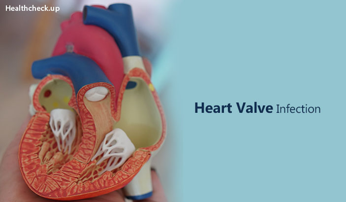 Heart Valve Infection