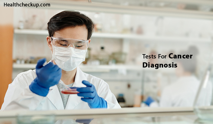 Tests for cancer diagnosis