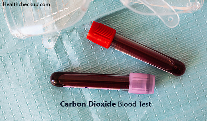 Carbon Dioxide Blood Test