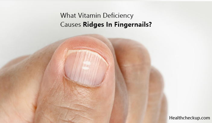 What Vitamin Deficiency Causes Ridges In Fingernails?