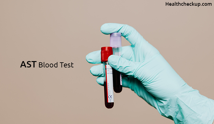 AST Blood Test