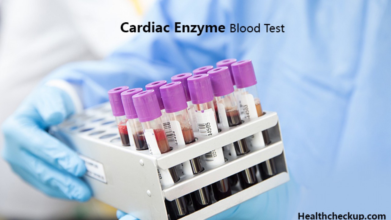 Cardiac Enzyme Blood Test- Low, High, And Normal Values