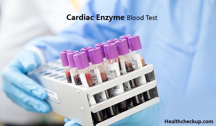 Cardiac Enzyme Blood Test