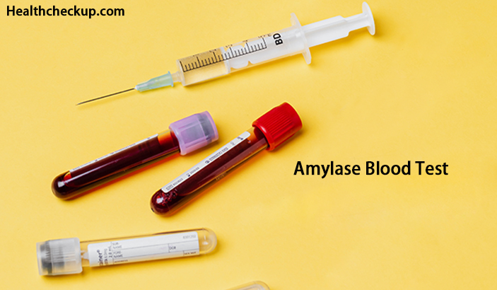 Amylase Blood Test Normal Range, High, And Low