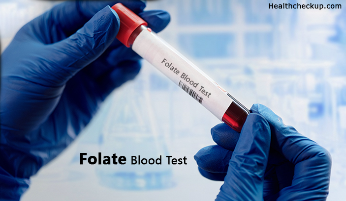 Folate Blood Test