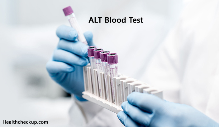 ALT Blood Test