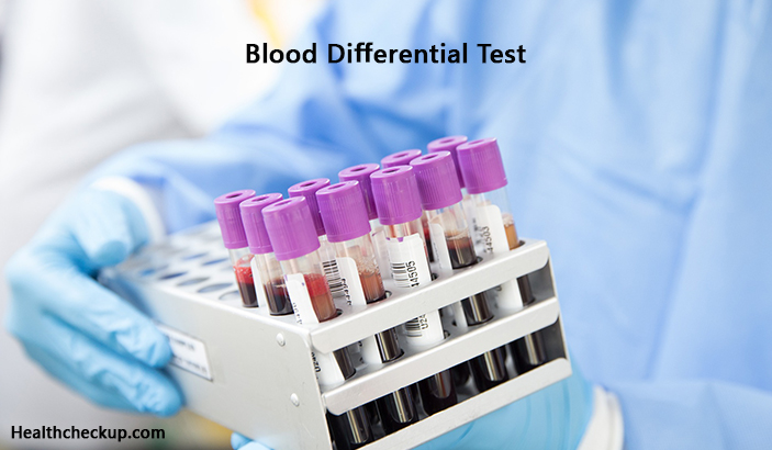 Blood Differential Test