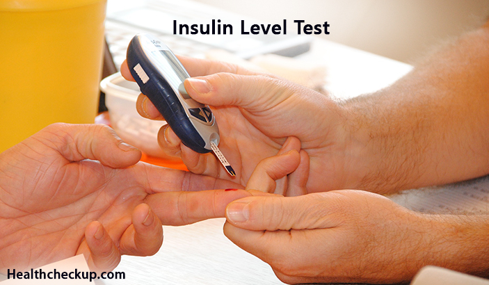 Insulin Level Test