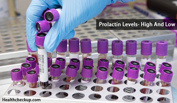 Prolactin Levels- High And Low