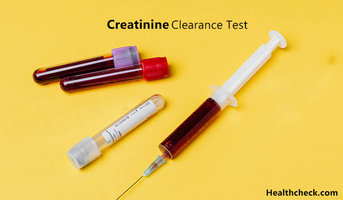 Creatinine Clearance Test