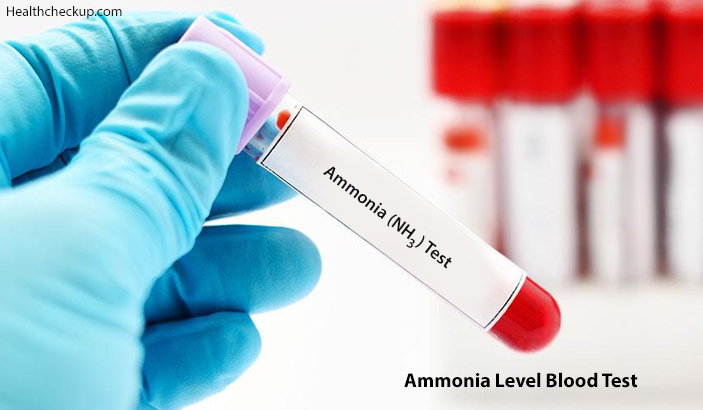 Ammonia Level Blood Test